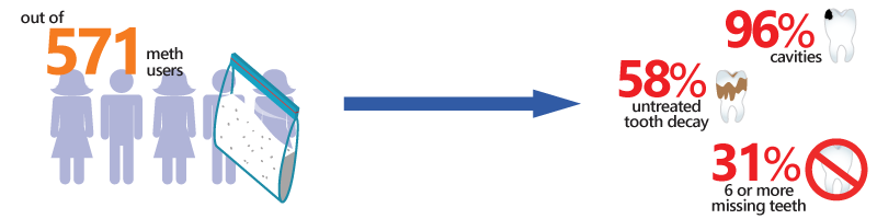 meth mouth statistics graphic